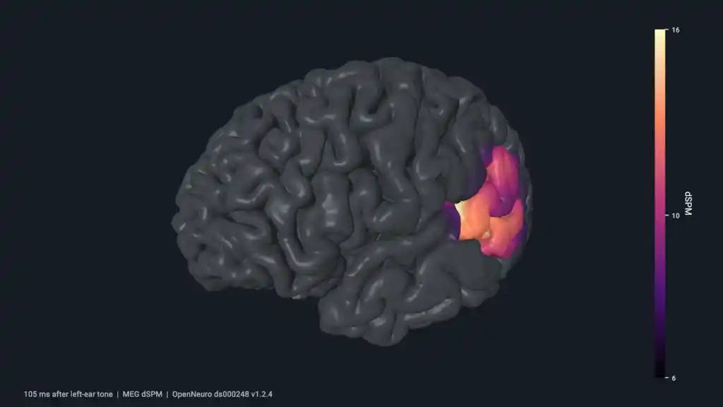 Human cortical activity projected onto a rotating brain surface